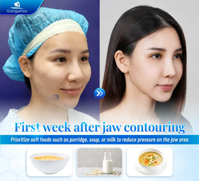 Does Jaw Reduction Surgery Leave Scars? Cases That May Increase the Risk of Scarring