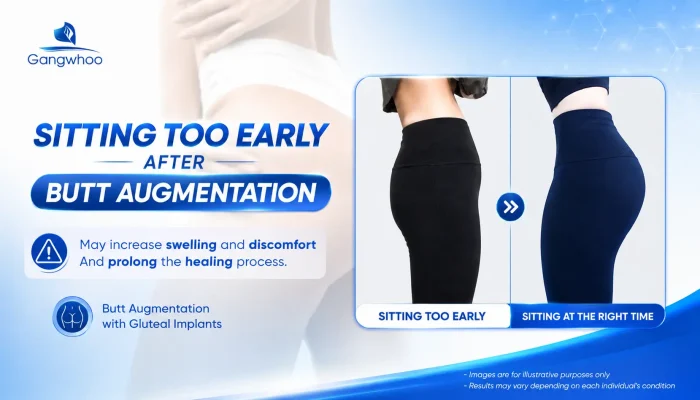 How Long After Butt Augmentation Can You Sit? A Medically Guided Recovery Timeline