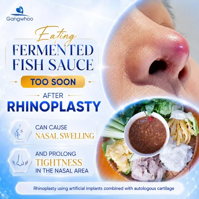 Can You Eat Fermented Fish Sauce After Rhinoplasty? Foods to Avoid During Recovery