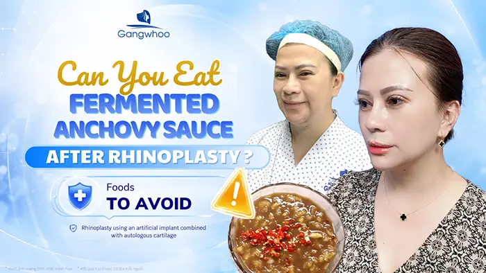 Can You Eat Fermented Fish Sauce After Rhinoplasty? Foods to Avoid During Recovery