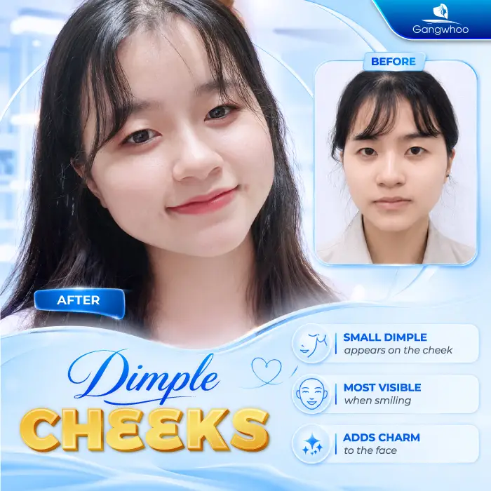 What Is a Dimple? Meaning and How to Create Natural, Beautiful Dimples