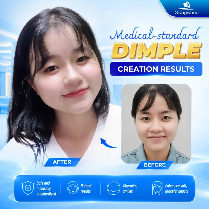 What Is a Dimple? Meaning and How to Create Natural, Beautiful Dimples