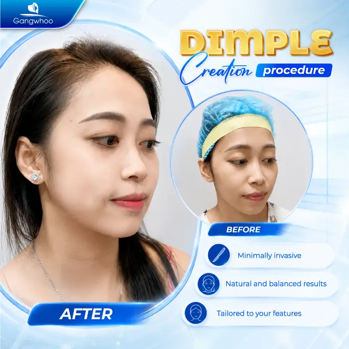 What Is a Dimple? Meaning and How to Create Natural, Beautiful Dimples