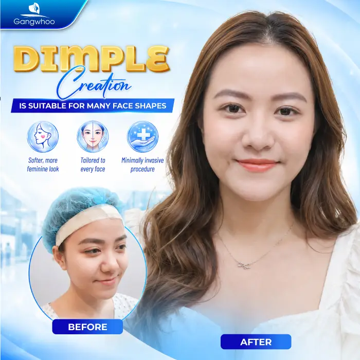 What Is a Dimple? Meaning and How to Create Natural, Beautiful Dimples