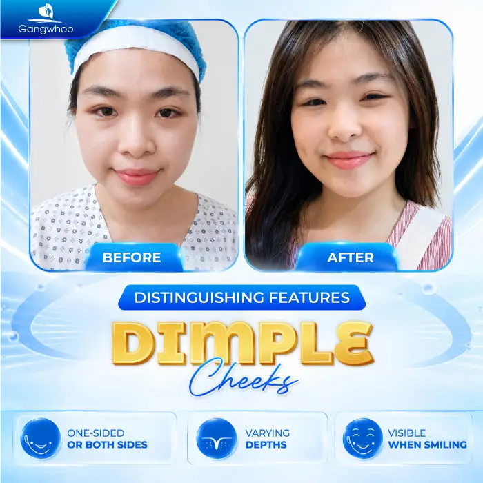 What Is a Dimple? Meaning and How to Create Natural, Beautiful Dimples