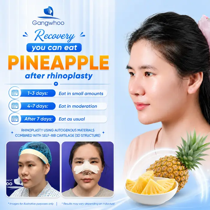Can You Eat Pineapple After Rhinoplasty? How Long Should You Avoid It?