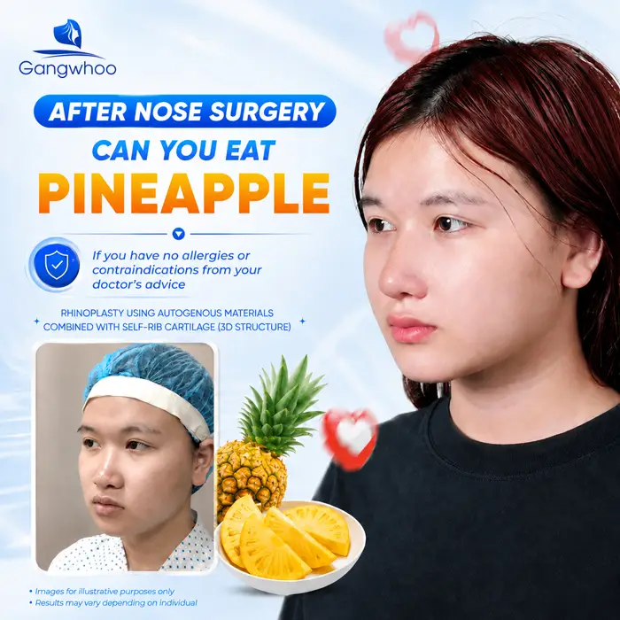 Can You Eat Pineapple After Rhinoplasty? How Long Should You Avoid It?