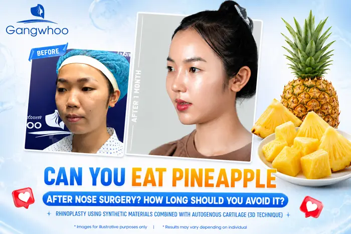 Can You Eat Pineapple After Rhinoplasty? How Long Should You Avoid It?
