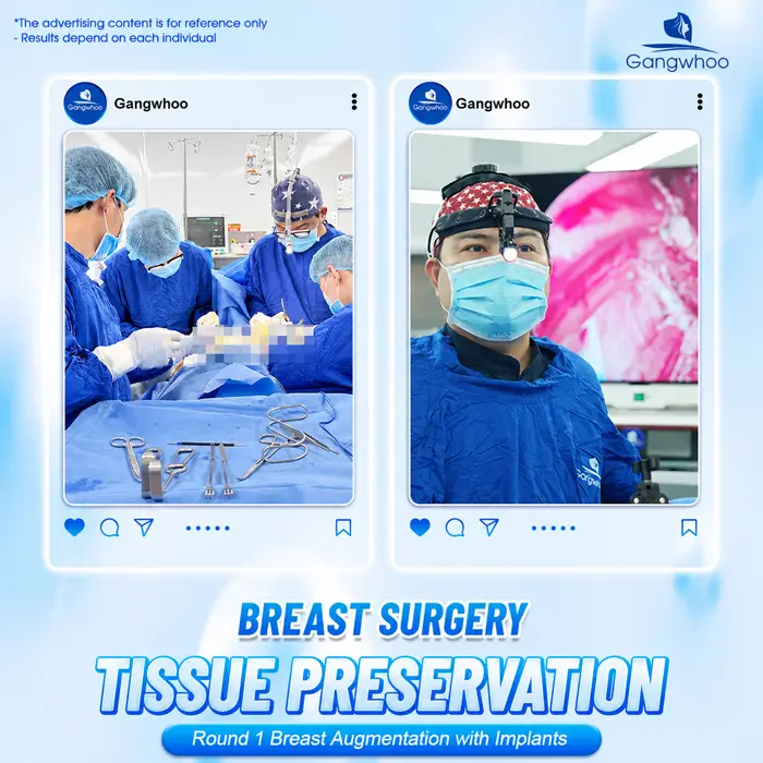 Breast Augmentation with Tissue Preservation: A New-Generation Tissue-Preserving Approach