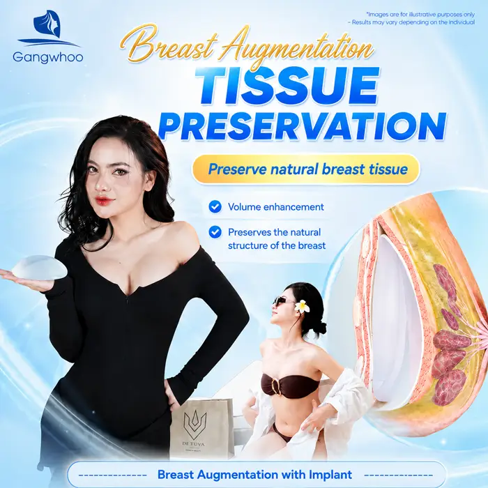 Breast Augmentation with Tissue Preservation: A New-Generation Tissue-Preserving Approach