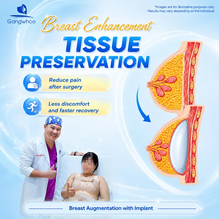 Breast Augmentation with Tissue Preservation: A New-Generation Tissue-Preserving Approach