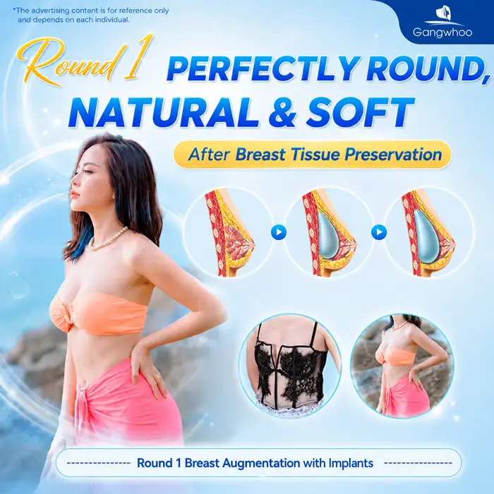 Breast Augmentation with Tissue Preservation: A New-Generation Tissue-Preserving Approach