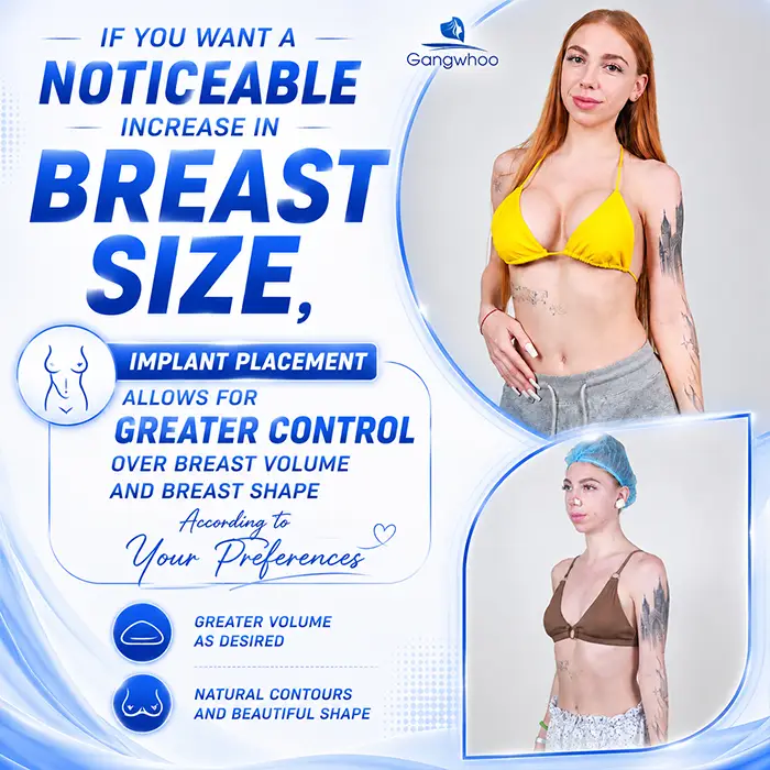 What Is the Difference Between Breast Injection and Breast Augmentation? Key Criteria for Differentiation