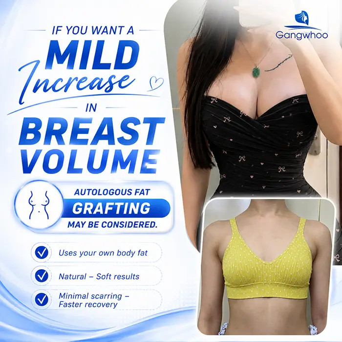 What Is the Difference Between Breast Injection and Breast Augmentation? Key Criteria for Differentiation