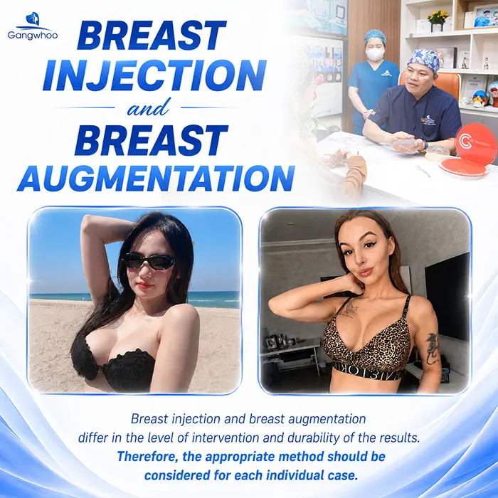 What Is the Difference Between Breast Injection and Breast Augmentation? Key Criteria for Differentiation