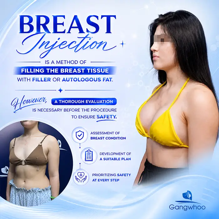 What Is the Difference Between Breast Injection and Breast Augmentation? Key Criteria for Differentiation