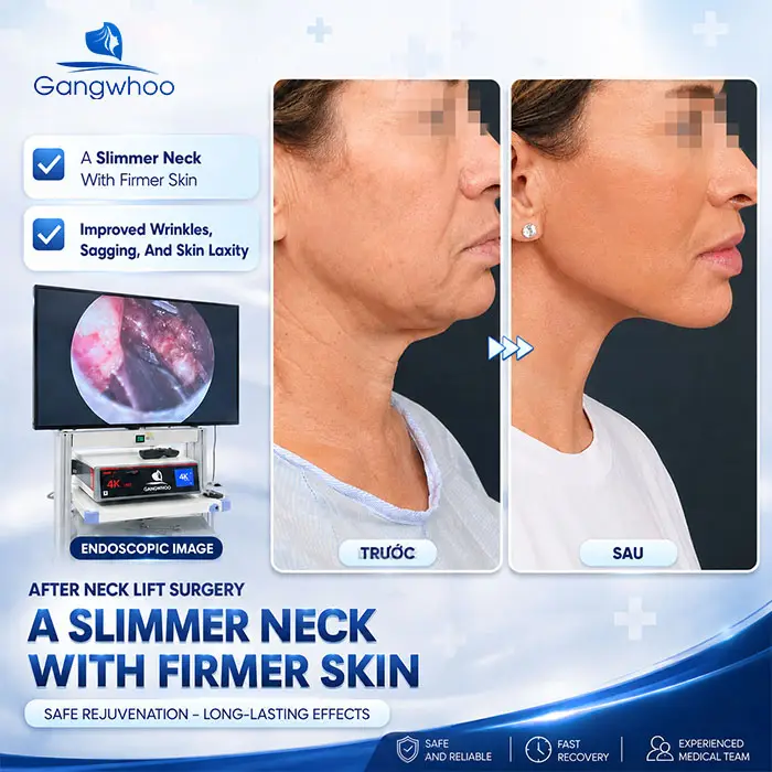 Neck Lift Cost: New 2026 Price List