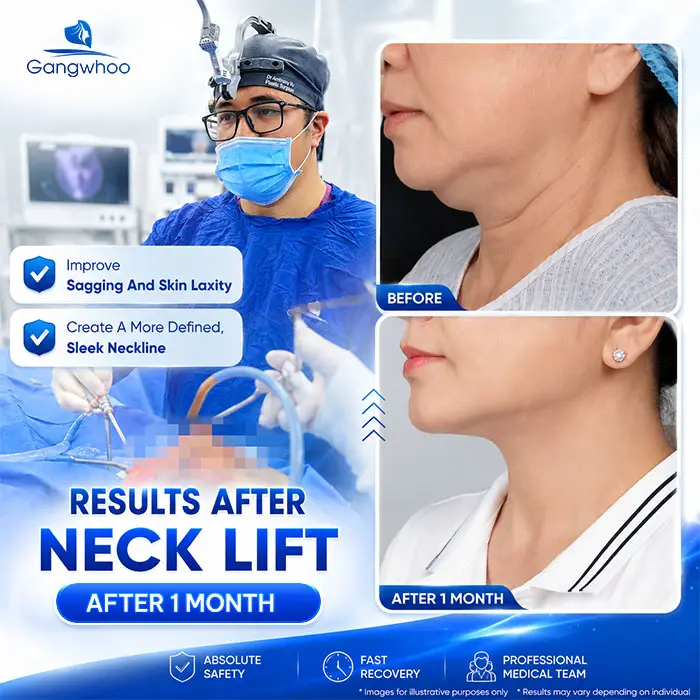 Neck Lift Cost: New 2026 Price List