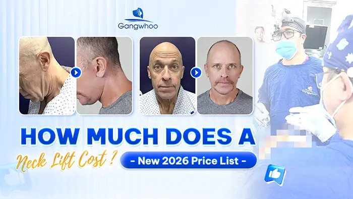 Neck Lift Cost: New 2026 Price List