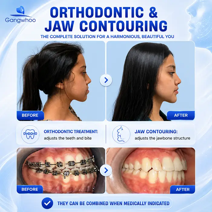 Can I Have Jaw Contouring Surgery While Wearing Braces? Doctor’s Answer