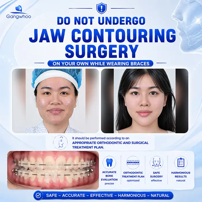 Can I Have Jaw Contouring Surgery While Wearing Braces? Doctor’s Answer