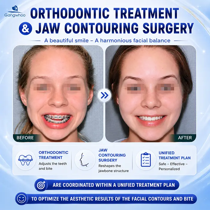 Can I Have Jaw Contouring Surgery While Wearing Braces? Doctor’s Answer