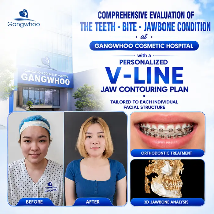 Can I Have Jaw Contouring Surgery While Wearing Braces? Doctor’s Answer