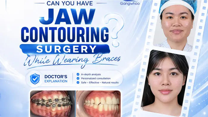 Can I Have Jaw Contouring Surgery While Wearing Braces? Doctor’s Answer