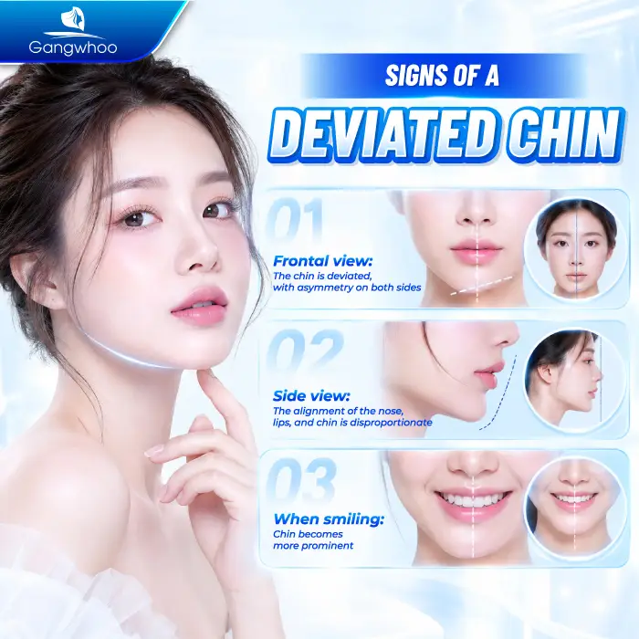 What to Do If Your Chin Implant Shifts Off-Center? Causes and Safe Correction Methods