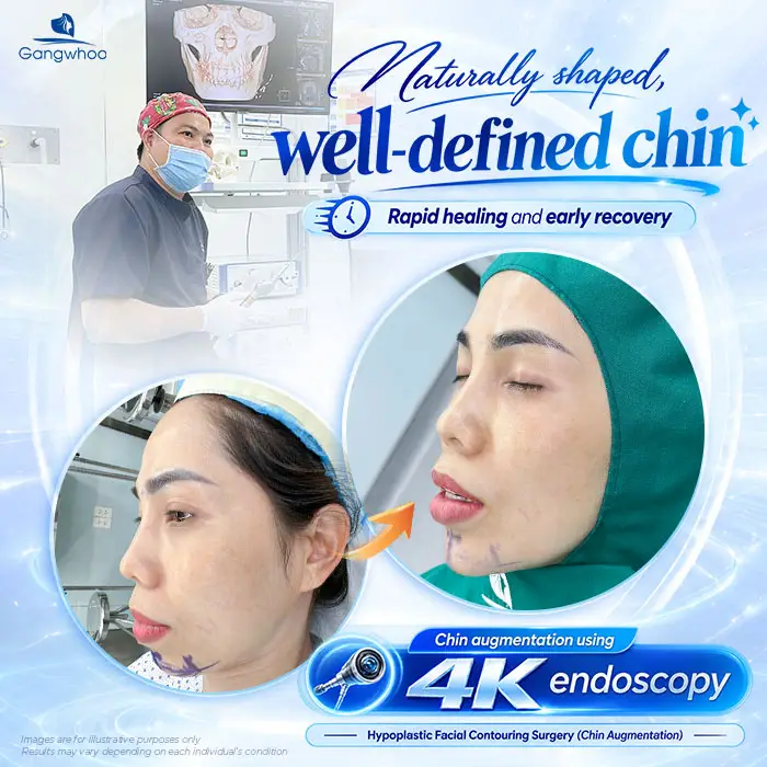 Does Chin Augmentation Hurt? Pain Level and Recovery Time