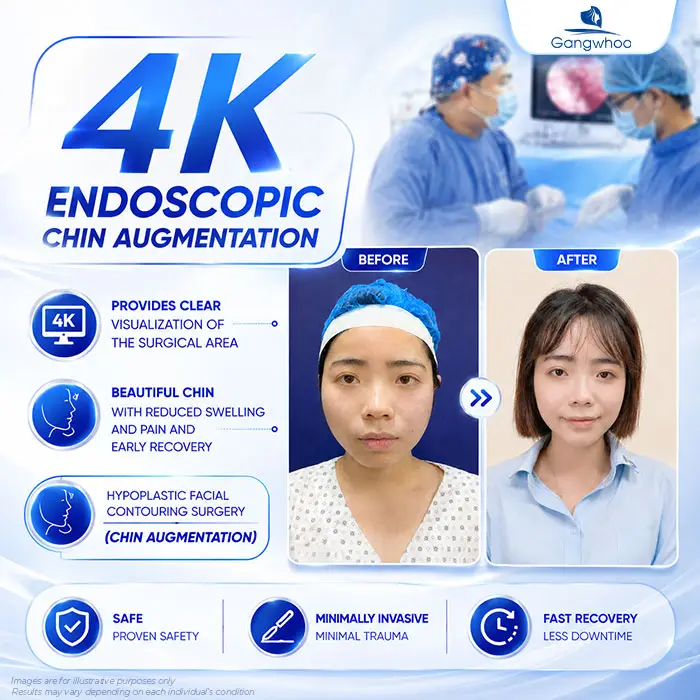 Does Chin Augmentation Hurt? Pain Level and Recovery Time