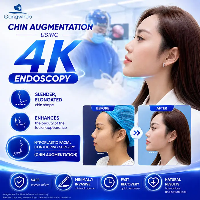 Does Chin Augmentation Hurt? Pain Level and Recovery Time
