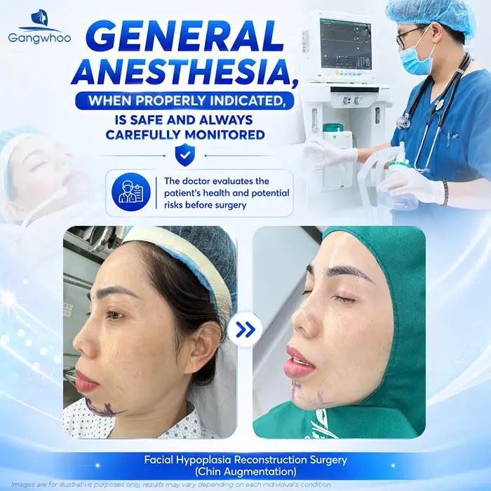 Does chin augmentation require general anesthesia? When Is Local Anesthesia Used, and When Is General Anesthesia Needed?