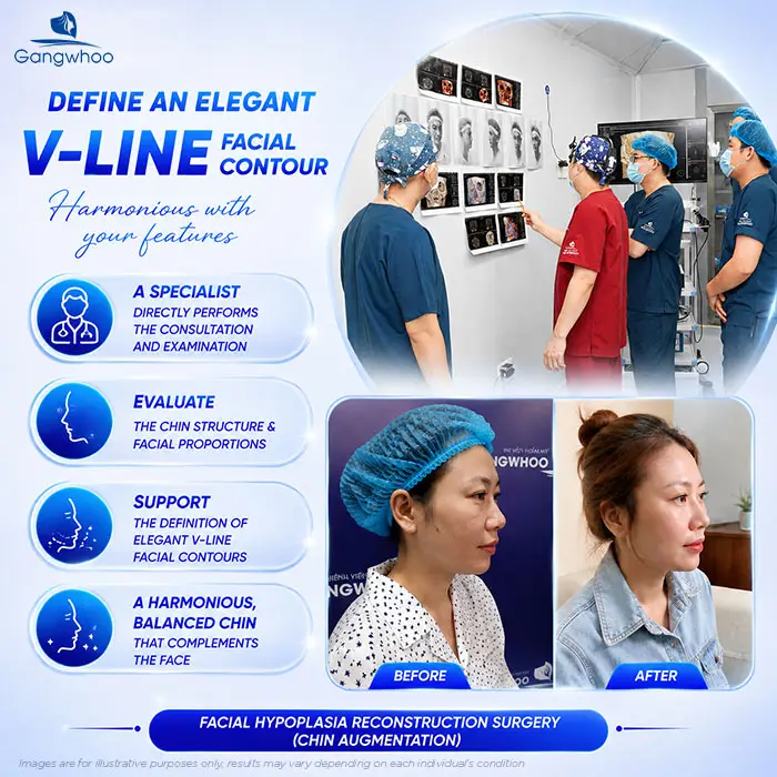 Does chin augmentation require general anesthesia? When Is Local Anesthesia Used, and When Is General Anesthesia Needed?