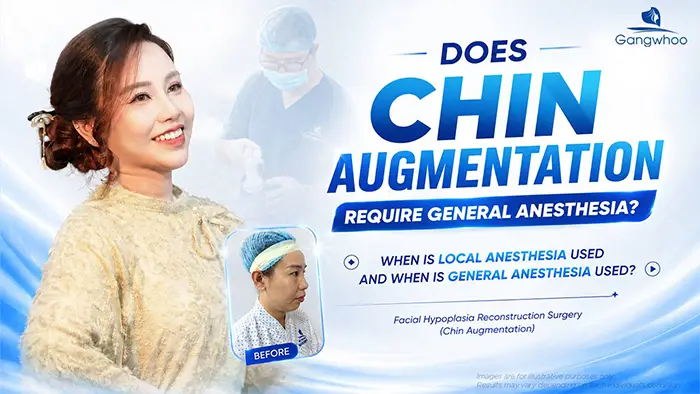 Does chin augmentation require general anesthesia? When Is Local Anesthesia Used, and When Is General Anesthesia Needed?