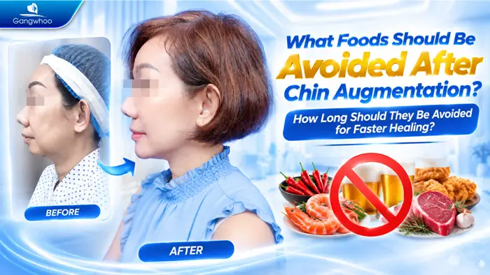 Chin Implant: What Foods to Avoid? How Long Should You Wait Before Eating Normally?