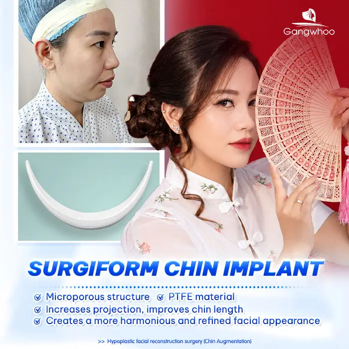 What Is Surgiform Cartilage Chin Augmentation? How Much Does It Cost?