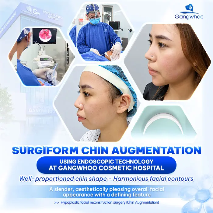What Is Surgiform Cartilage Chin Augmentation? How Much Does It Cost?