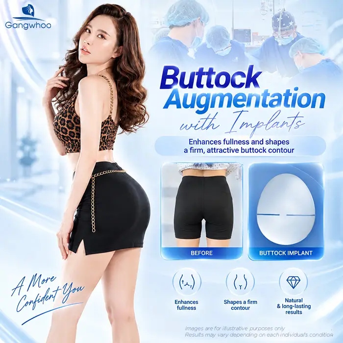 Does Butt Lift Surgery Hurt? How Long the Pain Lasts & How to Reduce It