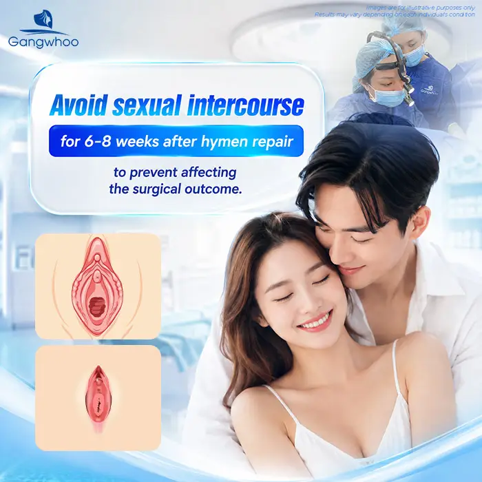 How Long After Hymenoplasty Can You Have Intercourse? Doctor Explains the Safe Timeline