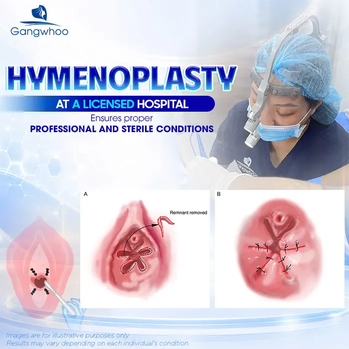Is Hymenoplasty Dangerous? An Expert’s Perspective
