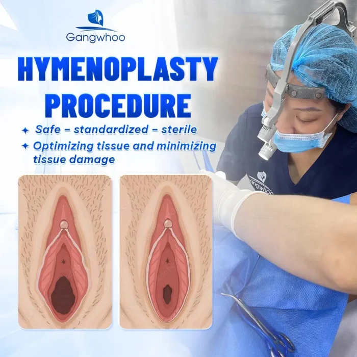 Is Hymenoplasty Dangerous? An Expert’s Perspective