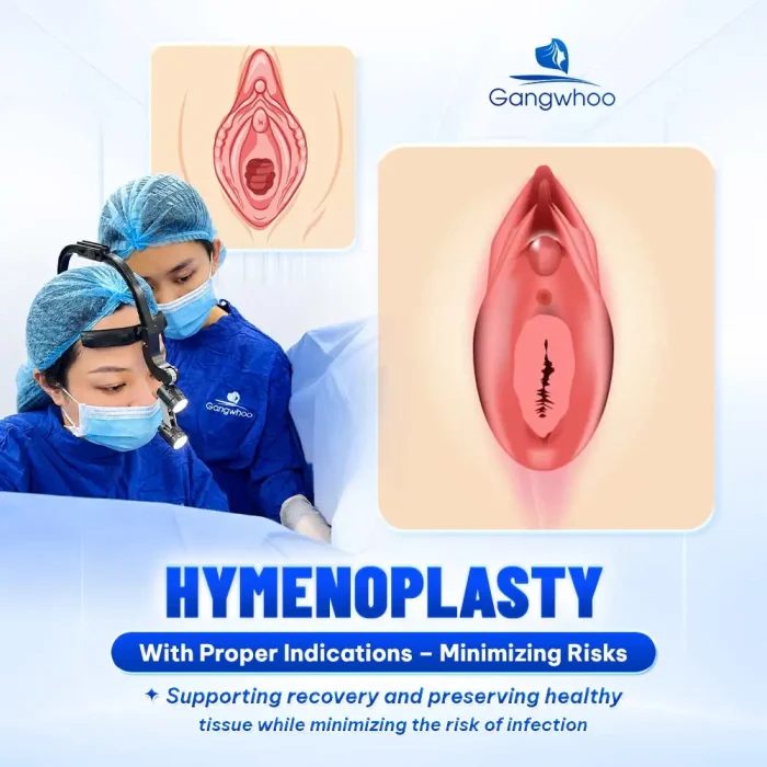 Is Hymenoplasty Dangerous? An Expert’s Perspective