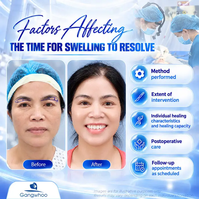 How Long Does Swelling Last After Brow Lift? Proper Aftercare