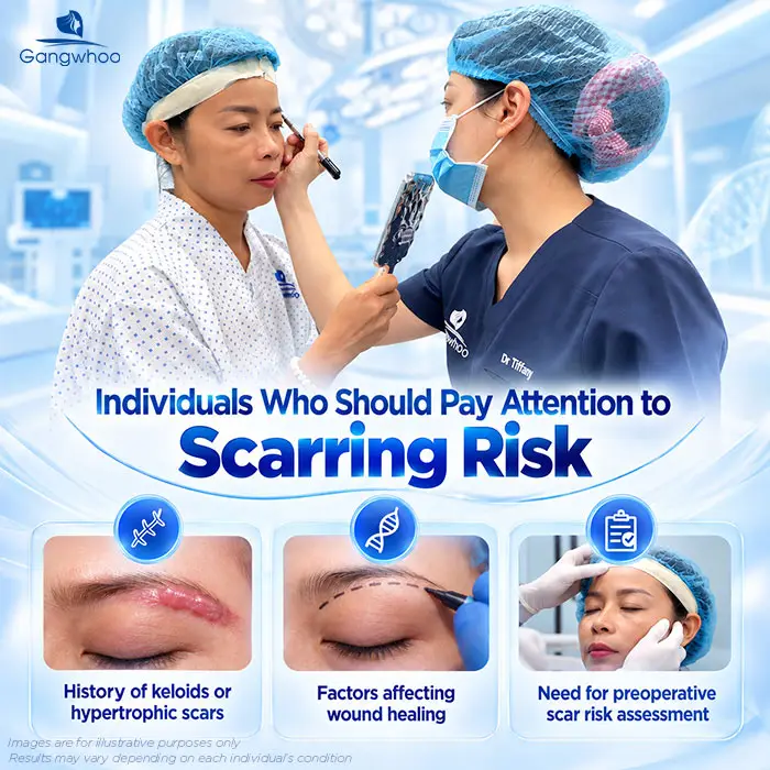 Does Brow Lift Surgery Leave Scars? A Guide to Minimizing Scarring