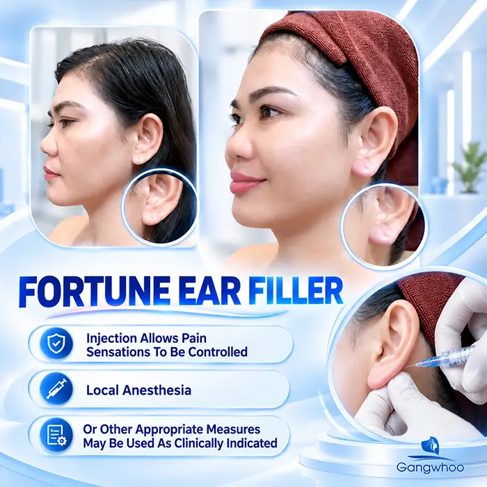 Does Fortune Earlobe Filler Injection Hurt? Pain Level And Ways To Reduce Discomfort