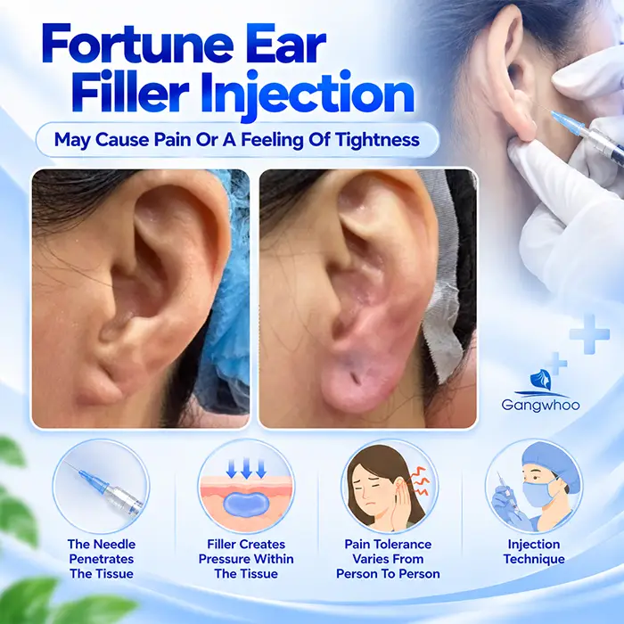 Does Fortune Earlobe Filler Injection Hurt? Pain Level And Ways To Reduce Discomfort