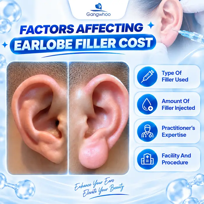 How Much Does “Fortune Ear” Filler Injection Cost? New 2026 Price List