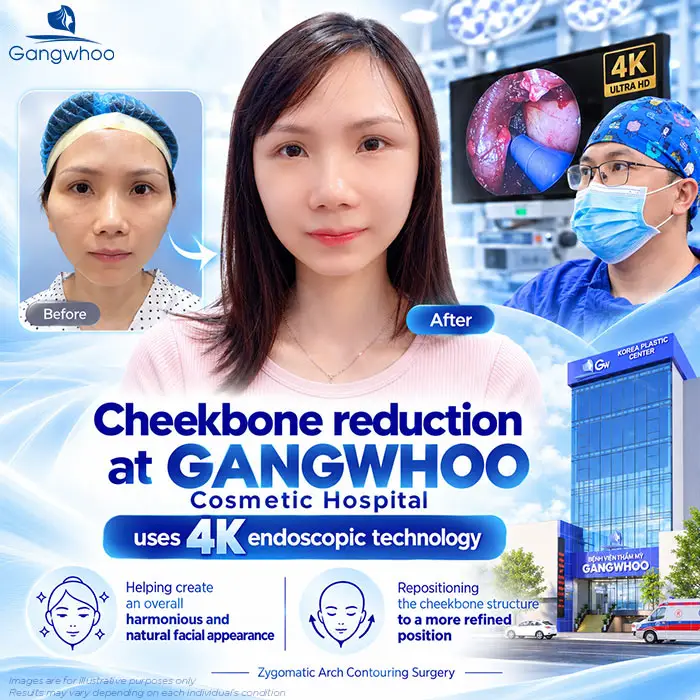 Does Cheekbone Reduction Cause Facial Sagging? Why Does Sagging Happen?