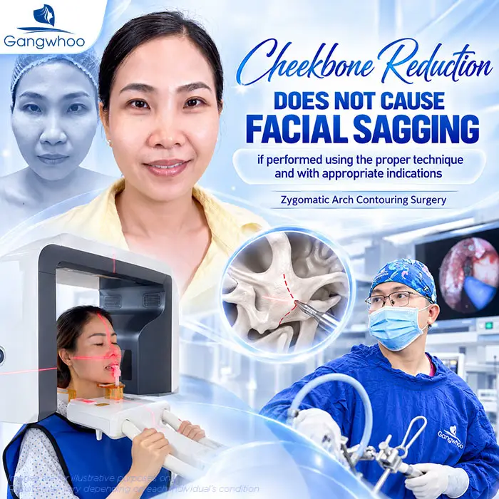 Does Cheekbone Reduction Cause Facial Sagging? Why Does Sagging Happen?